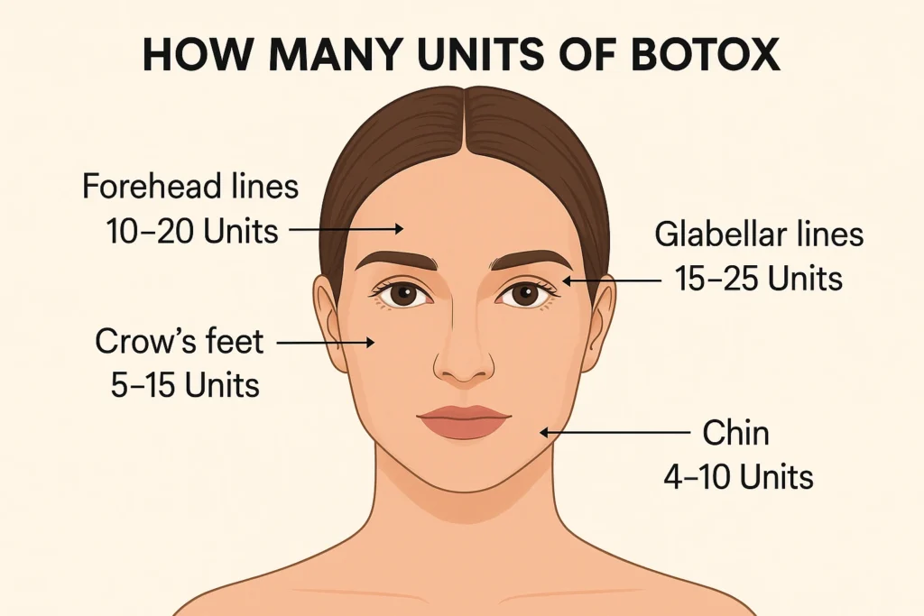 How Many Units of Botox Do I Need