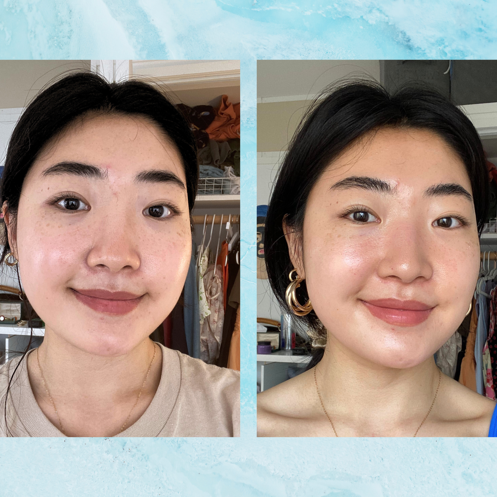 Are Hydrafacials Worth It