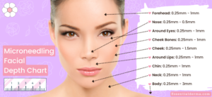 What Needle Length for Microneedling for Deep Acne Scars