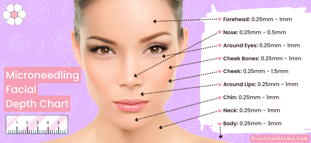 What Needle Length for Microneedling for Deep Acne Scars